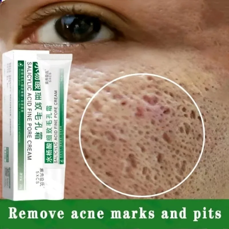 Korean Skincare Routine - Ácido salicílico poros limpeza creme encolher