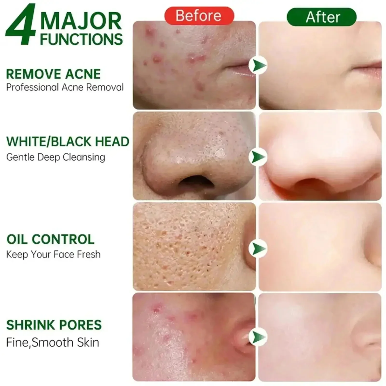 Ácido salicílico poros limpeza - Korean Skincare Routine avaliação e preço
